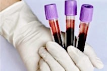 Кратко о значении показателей в ОАК, ОАМ, БХАК.