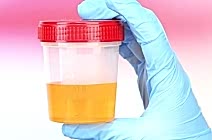 Общий Анализ Мочи собак (ОАМ)